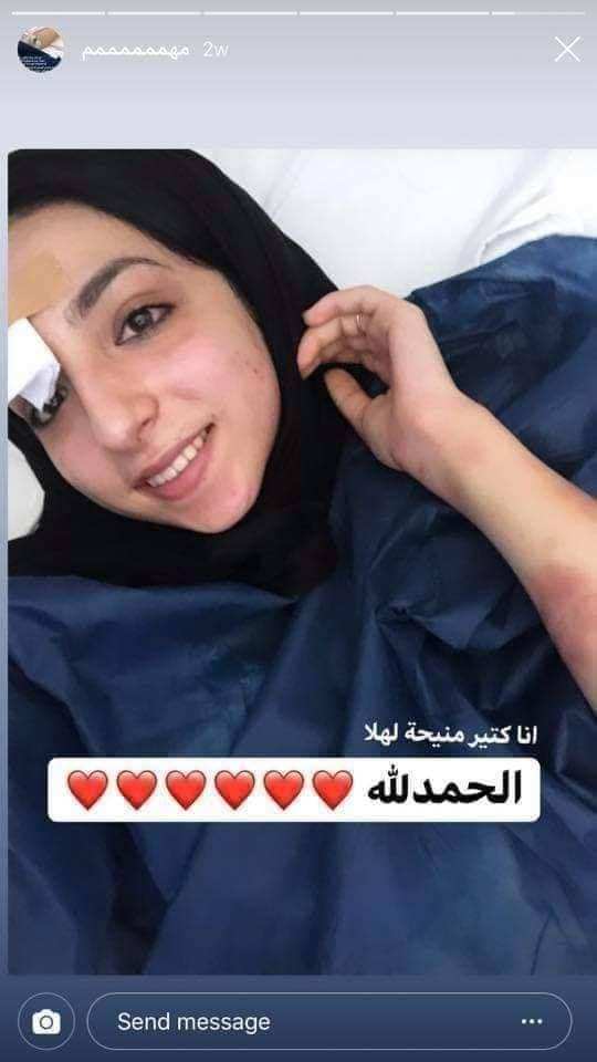 A selfie posted by Israa on her Instagram after being hospitalized shows bruises on her body, indicating domestic violence. She wrote on her selfie, “I am better now. Alhamdulillah.” Israa was beaten up to death at the hospital by her family members shortly after.